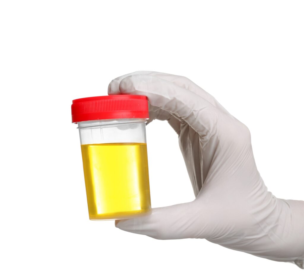 Urine Therapy