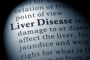 Liver Toxicity